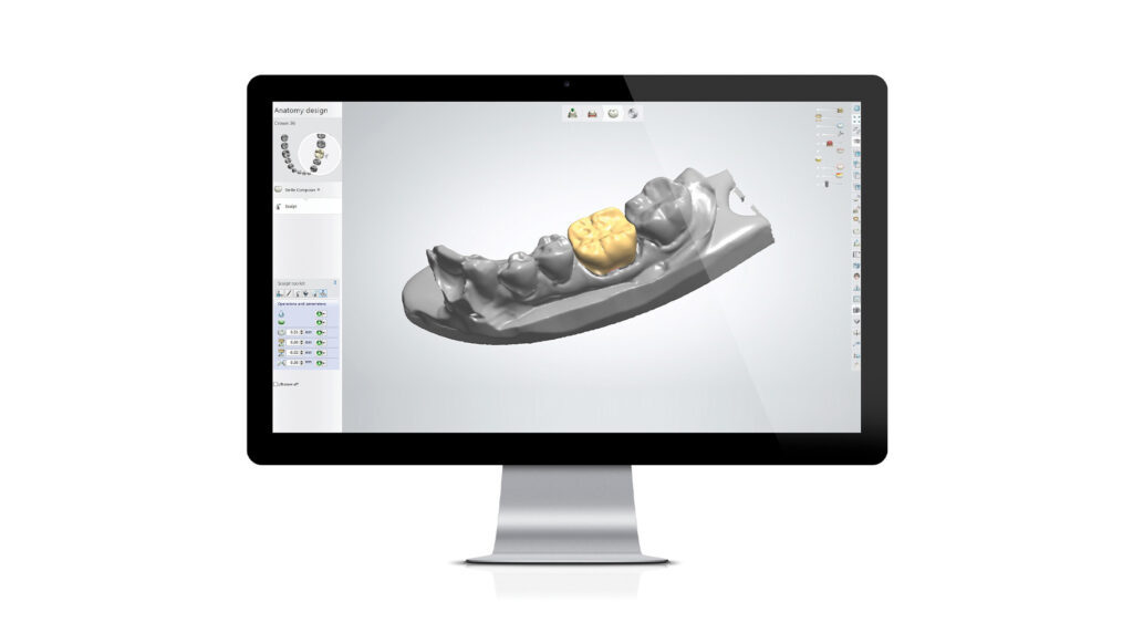 sending-impressions-from-a-3shape-trios-digital-scanner-southern-cross-dental-new-zealand