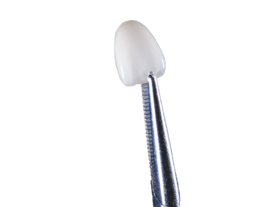 zirconia veneers